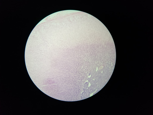 Adrenal Slides - Adrenal 004 100X